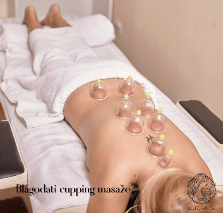 Blagodati cupping masaže